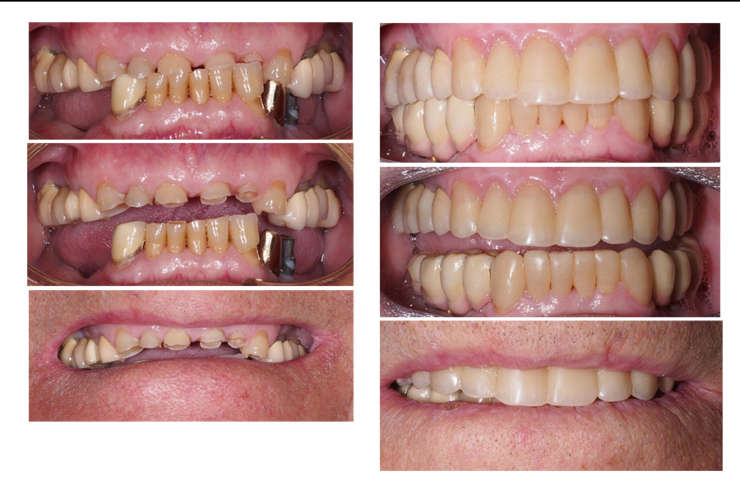 Odontología estética: la clave para lograr una bonita sonrisa… y mucho más
