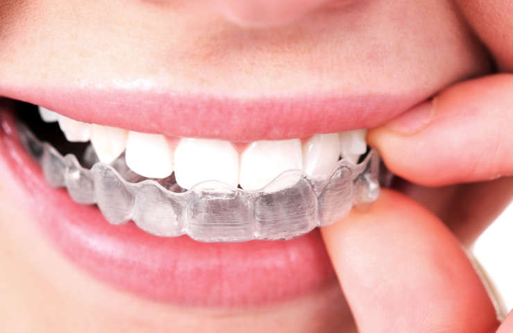 ¿Es la ortodoncia invisible igual de eficaz?