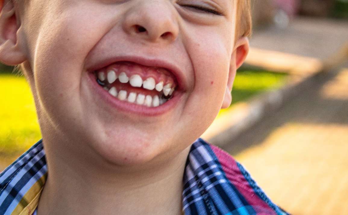 ¿Qué es y qué beneficios tiene la ortodoncia interceptiva en niños?
