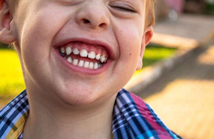 ¿Qué es y qué beneficios tiene la ortodoncia interceptiva en niños?