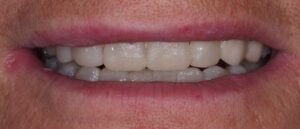 diseño sonrisa