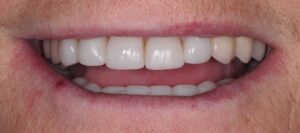 diseño sonrisa