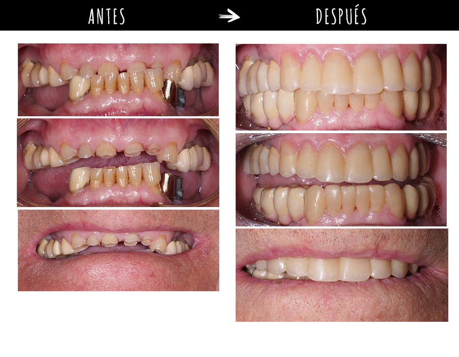 odontología estética