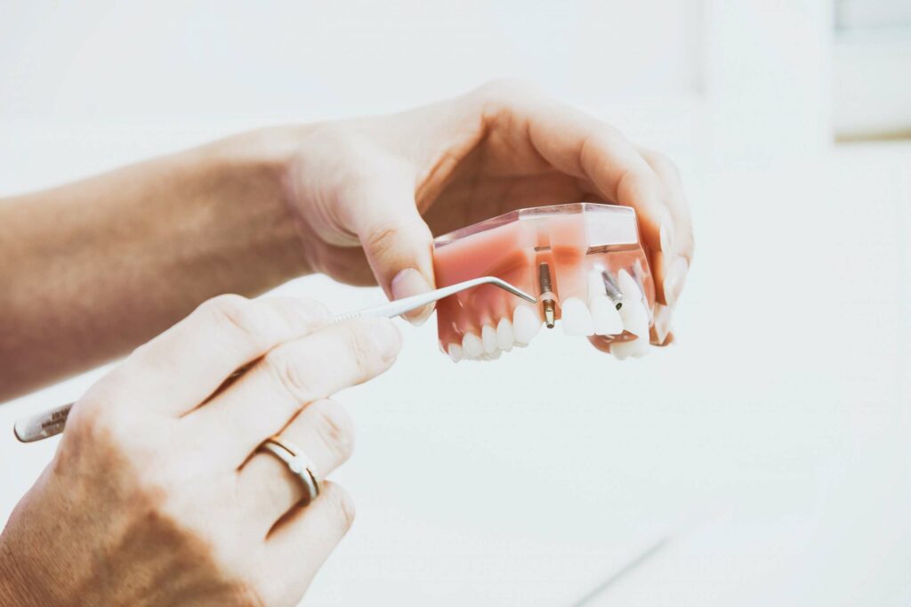 Implantes