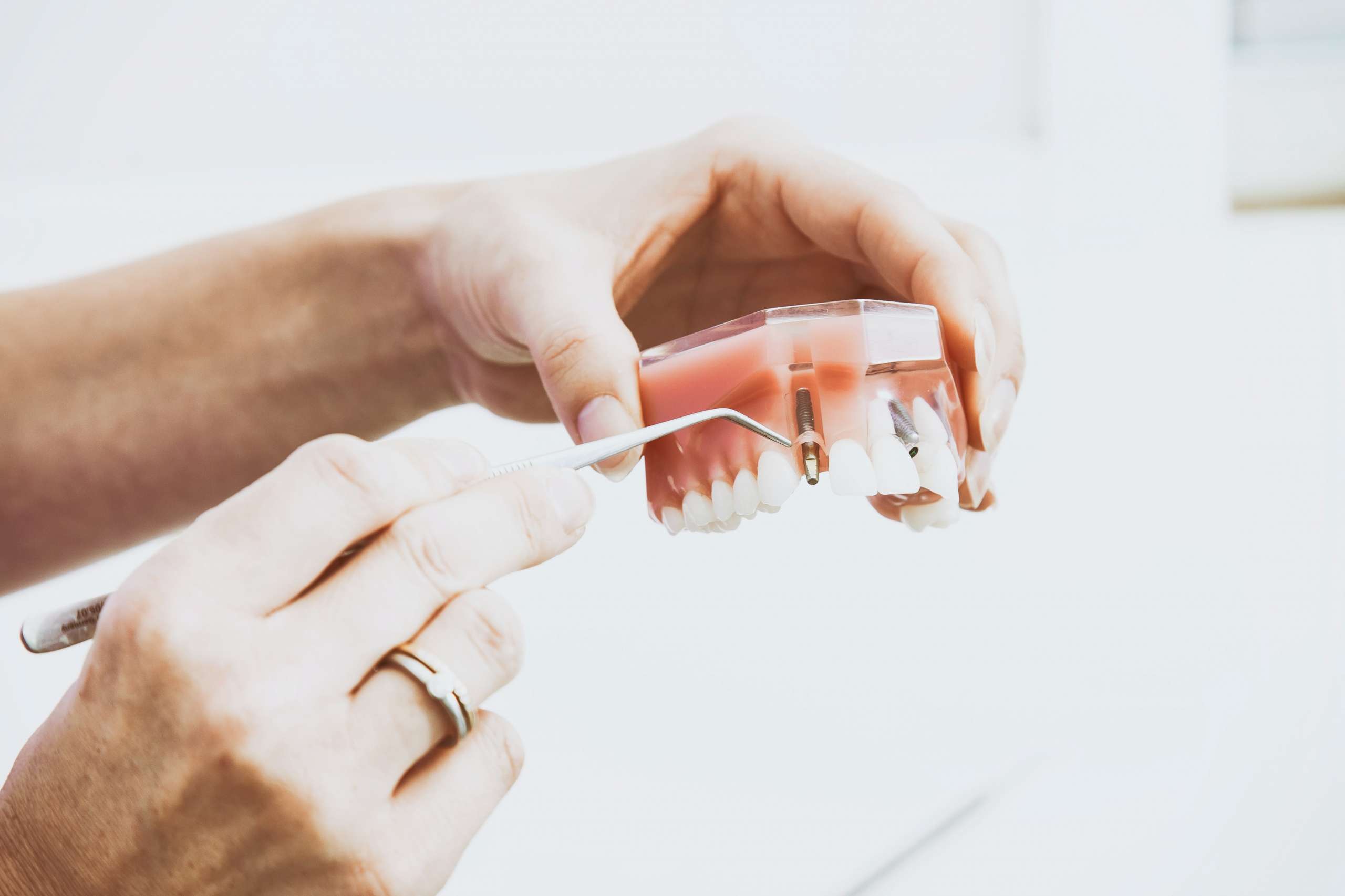 Implantes
