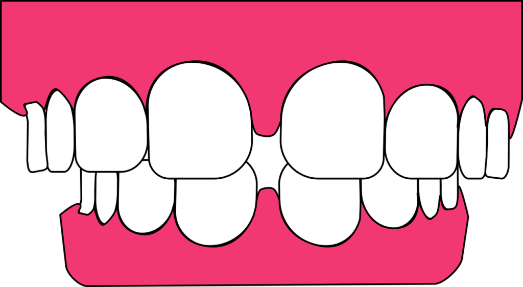 Enfermedades periodontales