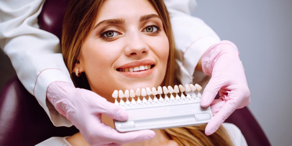 carillas dentales quien se pone